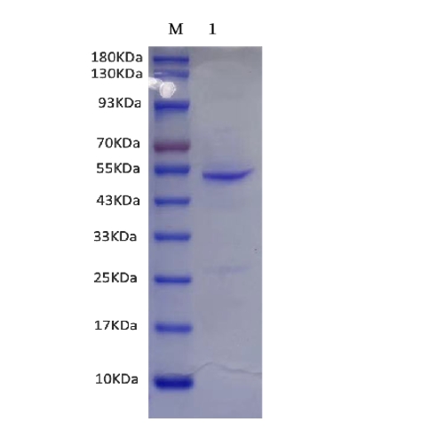 M: Marker
1: Recombinant RNase inhibitor